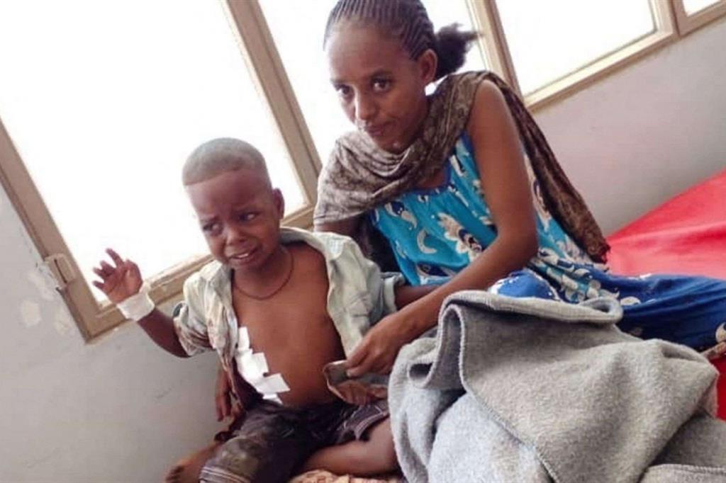Uno dei bambini rimasti feriti nell’attacco aereo dei droni etiopi di sabato scorso  a Dedebit nel Tigrai