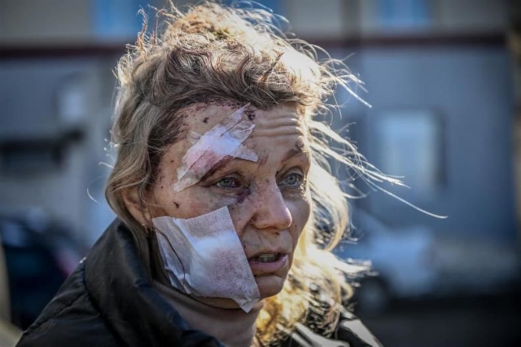 Olena, un anno dopo è ancora il volto della guerra in Ucraina