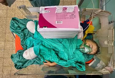 La tragedia di Gaza nella foto del bambino con le gambe amputate