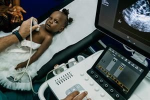 Il 90% dei bambini cardiopatici africani è senza cure