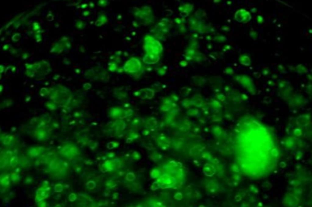 Un campione tridimensionale di tumore al pancreas illuminato tramite luce laser verde