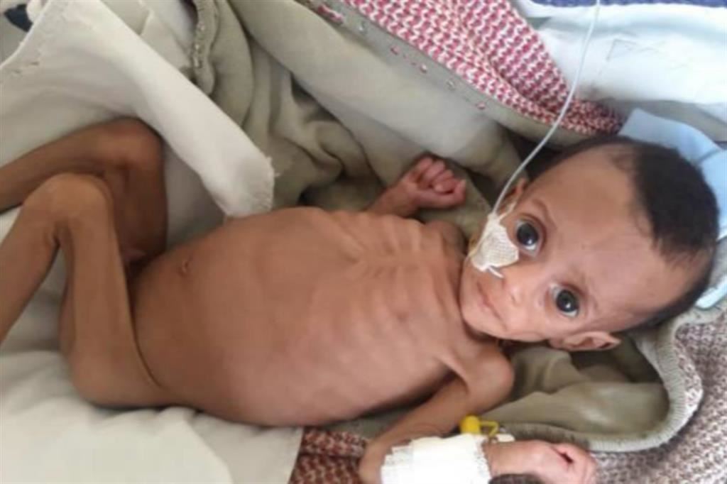 Gli effetti della fame su un neonato tigrino di cinque mesi